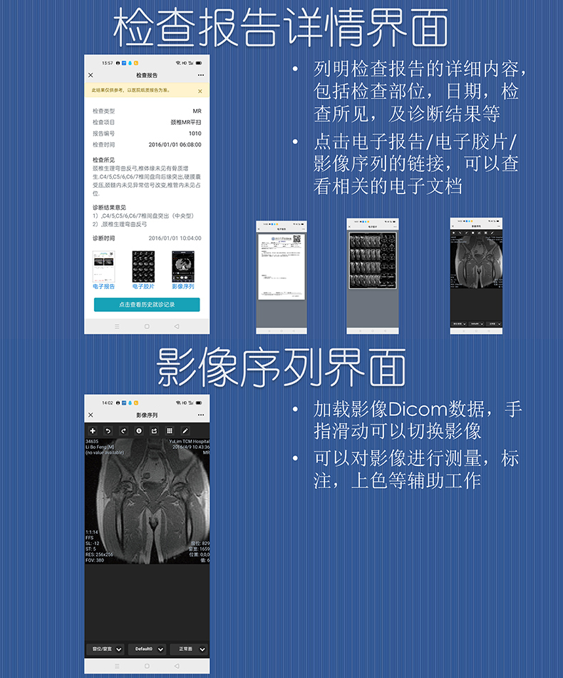 醫(yī)院放射透視檢測(cè)報(bào)告電子膠片檢查報(bào)告云管理系統(tǒng)軟件開(kāi)發(fā)APP小程序定制 醫(yī)院放射透視檢測(cè)報(bào)告電子膠片檢查報(bào)告云管理系統(tǒng)軟件開(kāi)發(fā)APP小程序定制