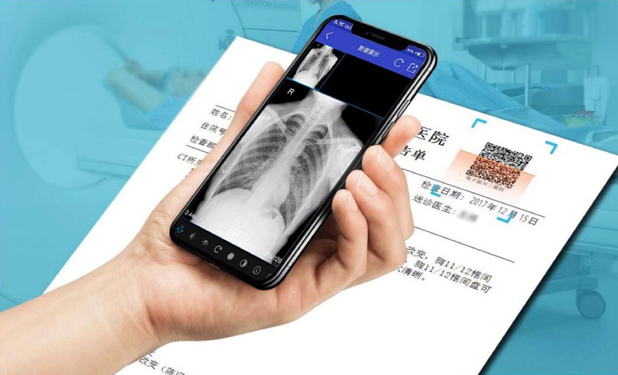 云膠片是什么？